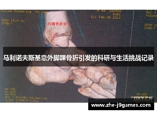马利诺夫斯基意外脚踝骨折引发的科研与生活挑战记录 马利诺夫斯基意外脚踝骨折引发的科研与生活挑战记录